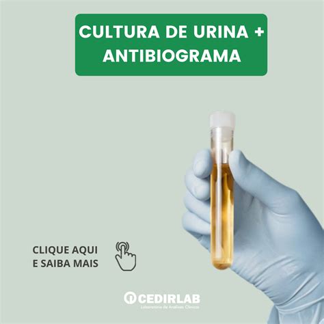 cultura de urina